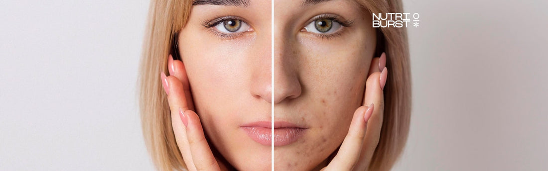 Unlocking the Radiance Within: Oral Vitamin C's Crusade Against Hyperpigmentation